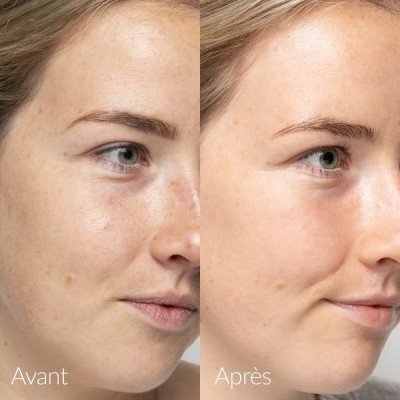 Caudalie - Sérum Éclat Anti-taches Vinoperfect