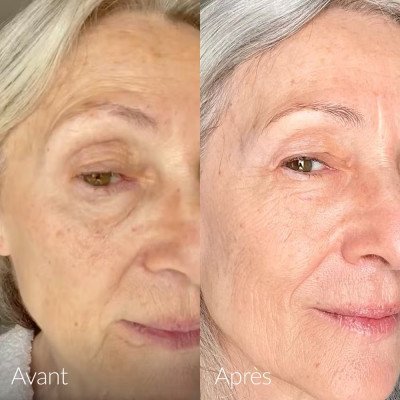 Caudalie - Sérum Éclat Anti-taches Vinoperfect